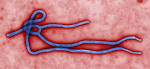 Microscopic view of a strand of Ebola